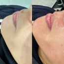 서산 라이제르 스튜디오 물광 풀페이스 왁싱