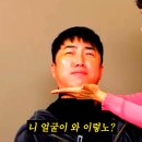 더이앤엠 | 😂장동민 실 리프팅 후기, 물만 닿아도 아팠던 일주일의 기록 "물만 닿아도 아팠다"