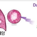 에스알메디 이미지