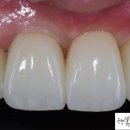 더힐 치과기공소 이미지