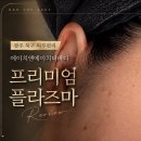 광주 북구 피부관리 에이치앤에이치더바디 프리미엄 플라즈마 후기 + 편사케어