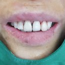 동의치과기공소 이미지