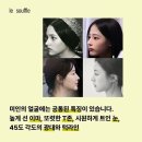 르수플 🌱 중안부 축소가 가능한 윤곽관리