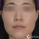 강남타토아의원 이미지