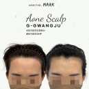 에이원헤어라인 이미지