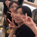 전진 | [내돈내산] 윤곽수술 1년후기 - 턱끝보형물제거+턱끝전진+얼굴지방흡입