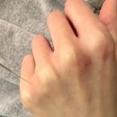 복한의원 네이버블로그