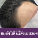 눈코입브로우