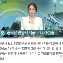 [SBS뉴스] “귓밥 못 참고 팠는데…” 상상도 못할 곳에 퍼졌다 이미지