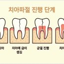 여의도예치과의원 네이버블로그